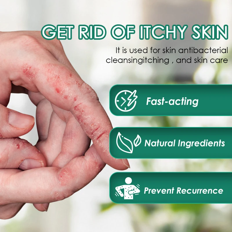 

Psoriasis Treatment Ointment Tinea Cruris Red Rash Relieve Itch Medical Cream