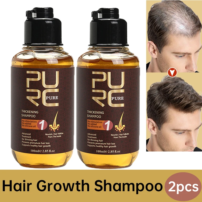 PURC 2 Pcs Ginger Hair Growth Shampoo Product Cleaning Scalp Oil Control Clogging Follicles Anti Hair Loss Beauty Health 100ml