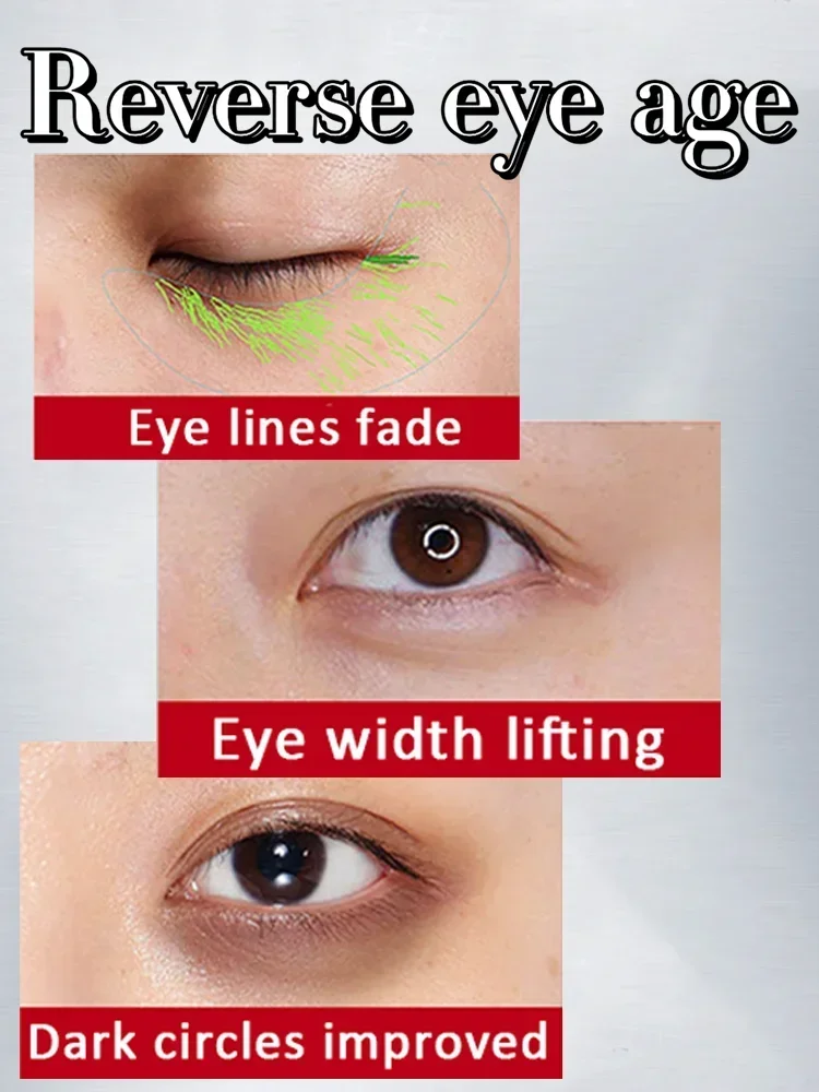 Крем для области вокруг глаз подтягивающий укрепляющий удаляет отеки и морщины