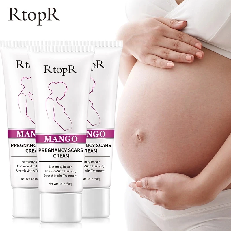 

Mango Stretch Marks Treatment Maternity Repair Anti-Aging Anti Winkles Firming Body Creams Remove Pregnancy Scars Acne Cream