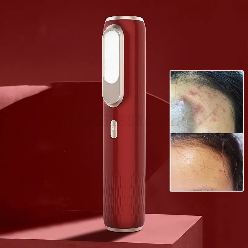 

Новый инструмент для удаления клещей после акне, Многофункциональный плазменный инструмент для отбеливания точек, нежный инструмент для красоты кожи