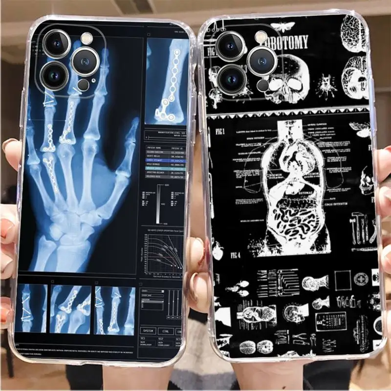 Radiological human organs Skeleton skull Phone Case For iPhone 8 7 6 6S Plus X SE 2020 XR XS 14 11 12 13 Mini Pro Max case