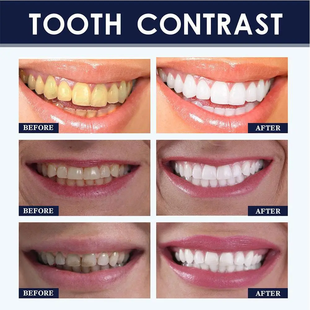 Рисунок 4 - Оригинальная зубная паста для отбеливания зубов