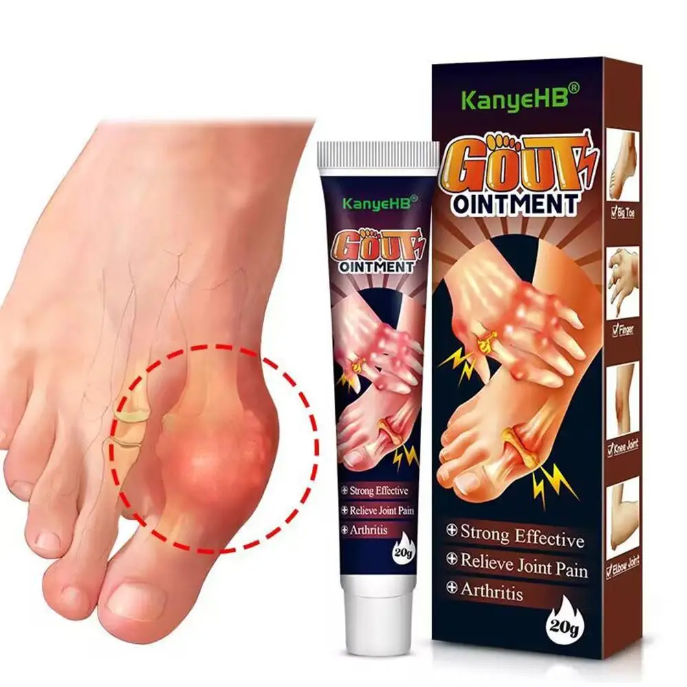 

20g Bunion Gout Pain Relief Ointment Toe Joint Valgus Corrector Cream Hallux Knee Lumbar Arthritis Treatment
