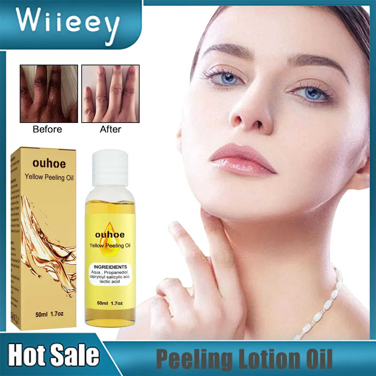 

Peeling Lotion for Body Whitening Bleaching Melanin Lightening Dark Spots Scrub Exfoliating Remove Dead Skin Yellow Peeling Oil