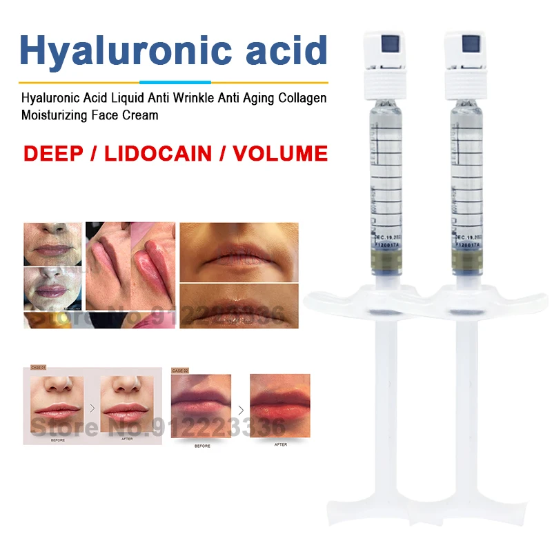 

1ml Lips Enhancement Crosslinked HA Hyaluronic Acid Serum Lip/Nose/Cheek Hyaluronic Acid for Hyaluron Pen N.euramis Skin Care