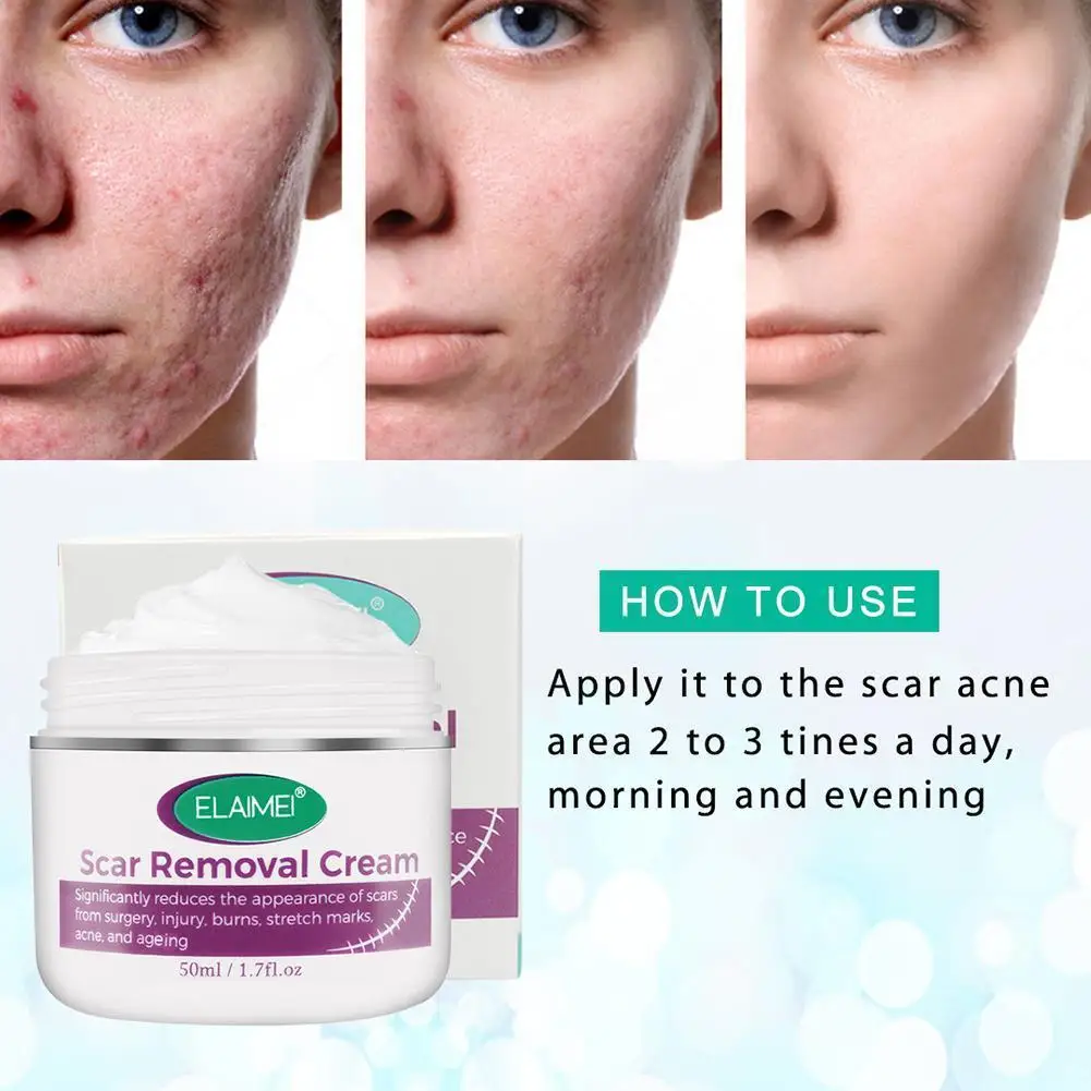 50 мл крем для удаления шрамов прыщи растяжки регенерация лица гель от угрей уход