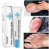 herbal antibacterial cream psoriasis gel quickly anti itch relief eczema skin rash urticaria desquamation treatment private care
