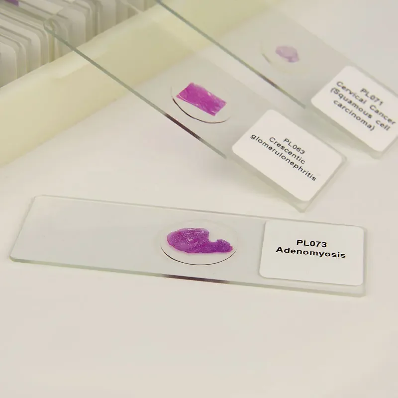 100 видов медицинских патологических секций человеческого тела типовые