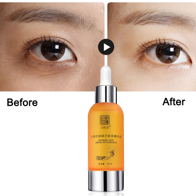 

Rungenyuan eye serum 35ml anti-dark circles and bags lifting for eyes cream serum anti-wrinkle for eyes original vitamin c care
