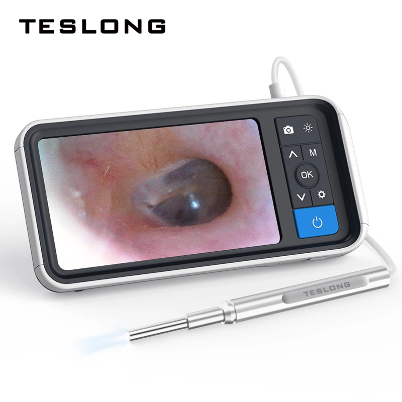 

3.9mm Diameter USB Digital Endoscope Otoscope for Ear Canal Inspection