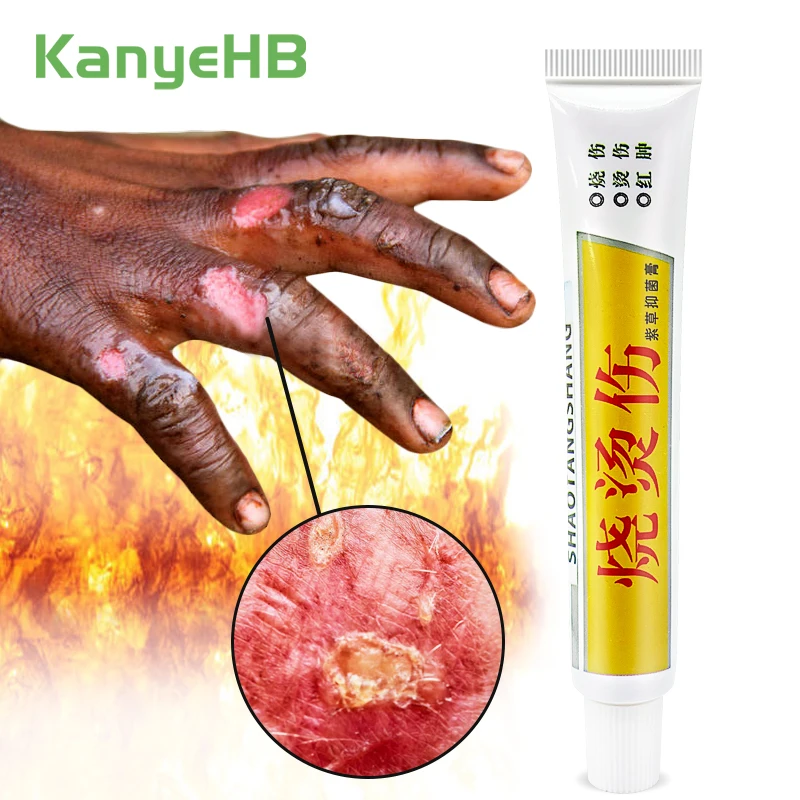 

1 шт. крем для ожогов и ожогов, лечение покраснения кожи, разбухание, ингибитор грибков, Стимулирует заживление кожи, китайская фотопластырь ...