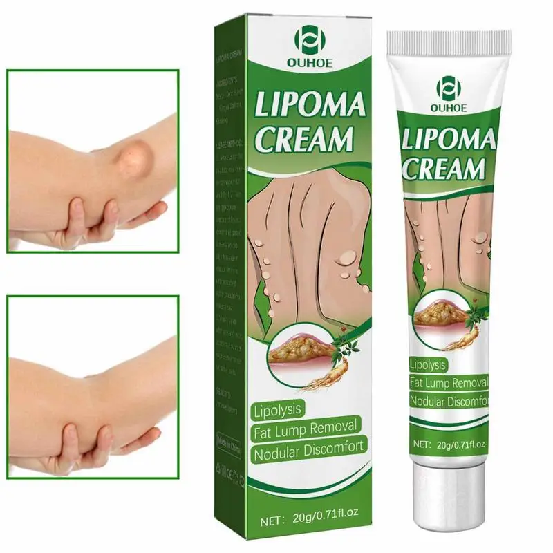 

Lipoma Removal Cream Fat Removal Ointment With Ginseng Saffron For Arms Legs Belly Body Care Organic Herbal LumpFree Lipoma Gel