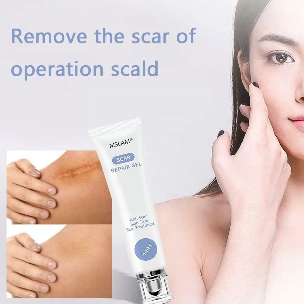 

Травяной крем для удаления шрамов гелевые растяжки восстанавливающий гель красота Прыщи увлажняющий крем Cosme отбеливание акне Гладкий рем...