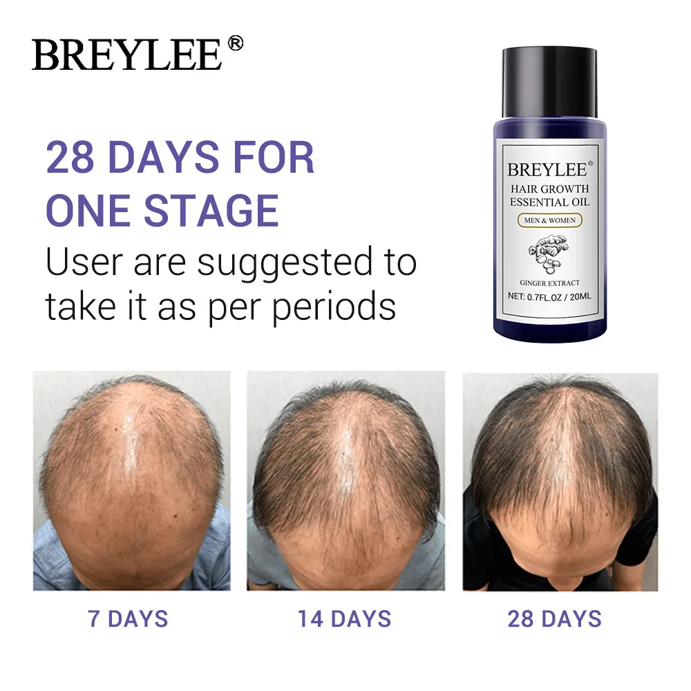 

BREYLEE Ginger Hair Growth Essential Oil Anti Hair Loss Fast Grow Serum Repair Dry Frizzy Damaged Nourish Scalp Treatments 20ml