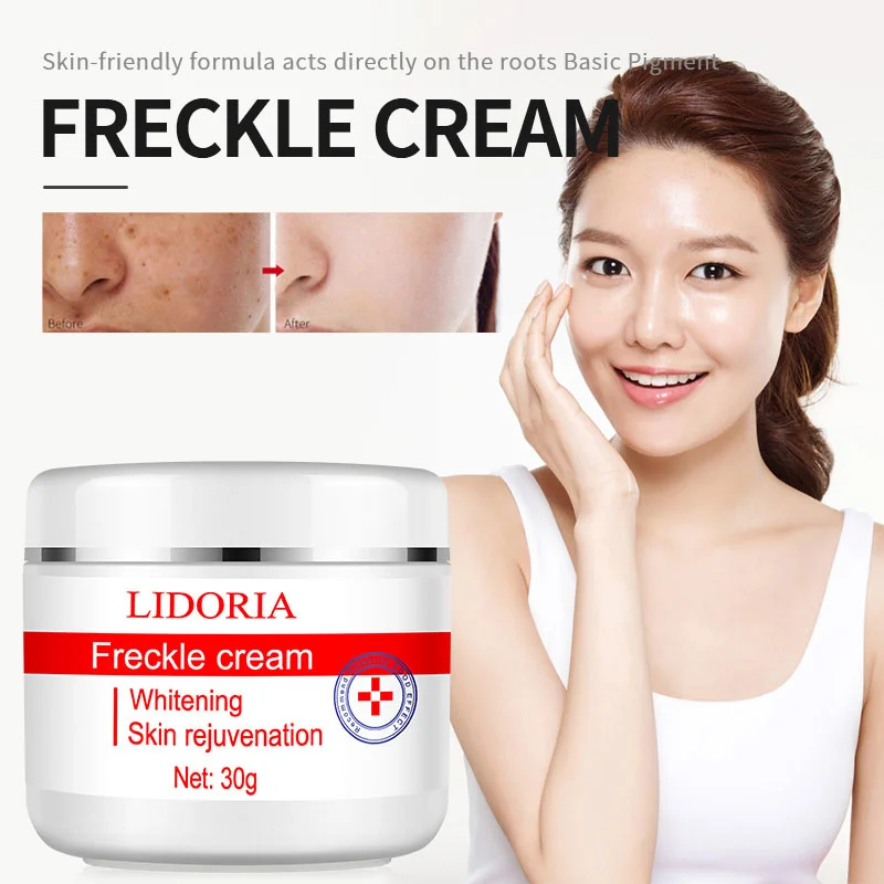 

Effective Whitening Freckle Face Cream Removal Melasma Acne Dark Spots Fade Pigment Melanin Brighten Moisturizing Beauty Product