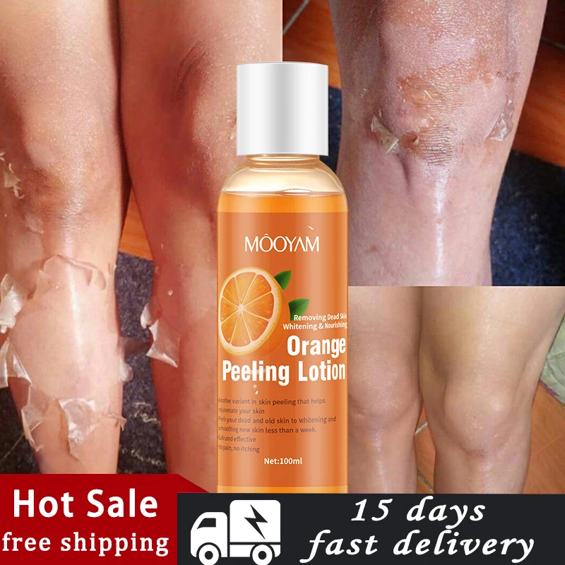 

Body Lotion Gentle Exfoliating Gel Orange Peeling Lotion Peeling Oil Against Rough and Dry Keratin Accumulation Whitening Body