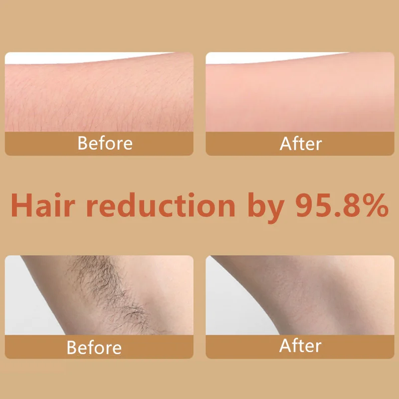 Рисунок 3 - Новый обновленный прозрачный ластик для удаления волос