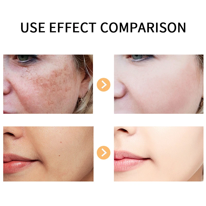 Prettycome витамин С лицо сыворотка отбеливающий гиалуроновая кислота противоморщинный антивозрастной увлажняющий выцветание темных пятен уход за лицом включить.