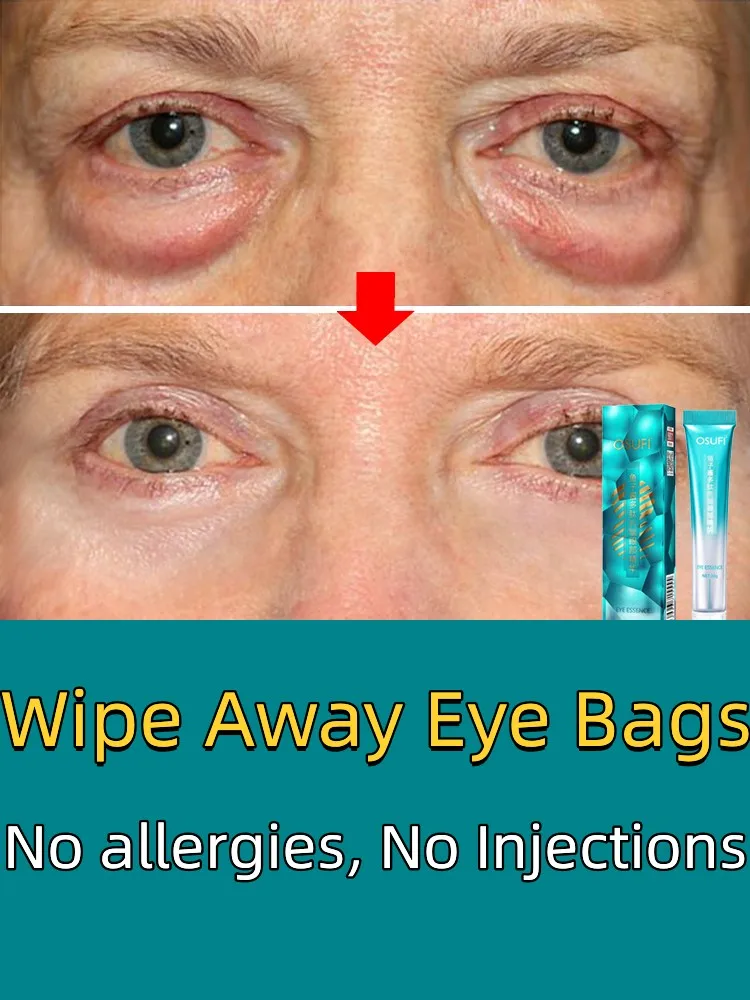 

Remove Eye Bags & Dark Circles Under Eye Cream Anti-Aging Lifting Wrinkle Firming Whitening Moisturizing Brighten Skin Care 20g