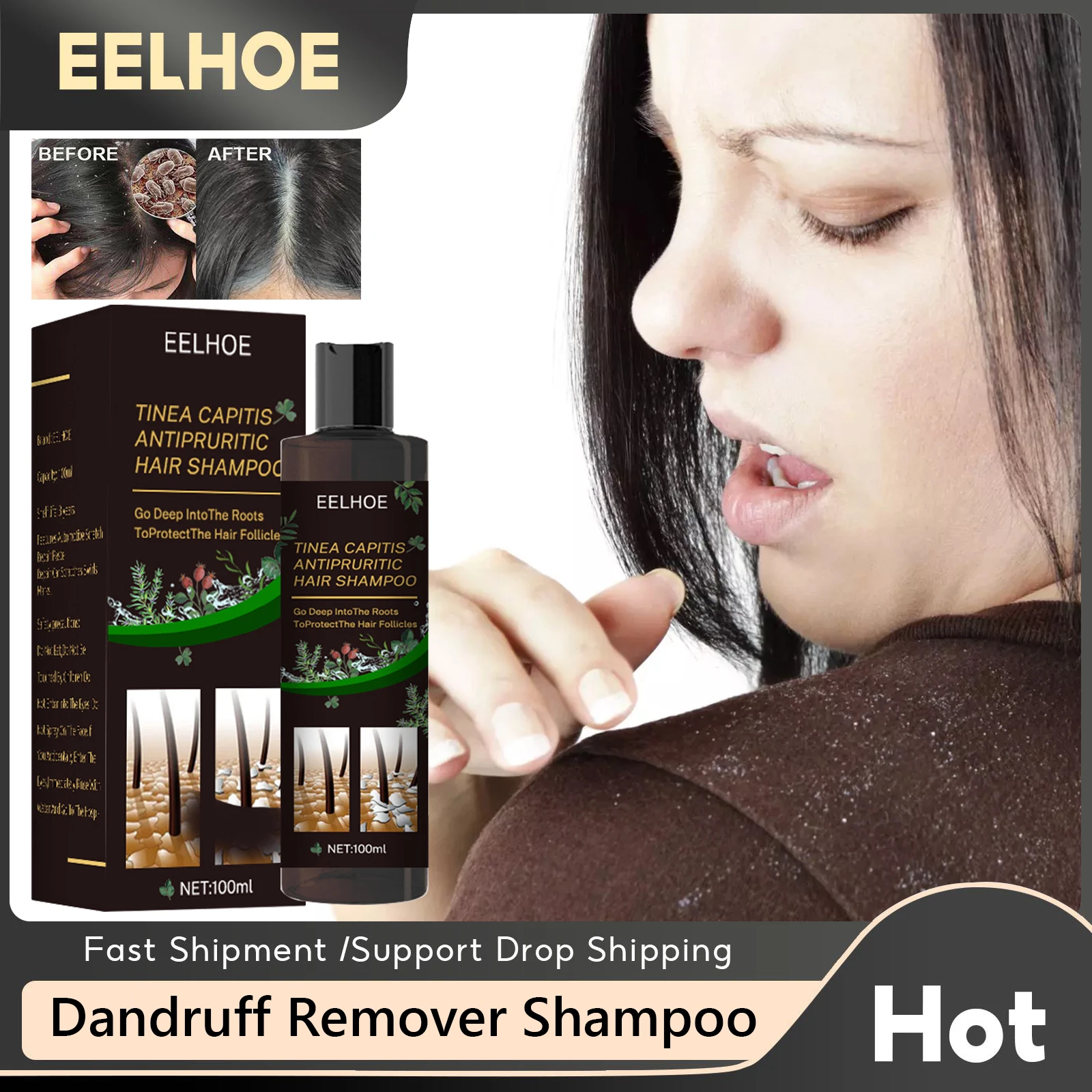 

Anti Dandruff ShampooTreatment Itching Flaking Scalp Control Oil Refreshing Psoriasis Seborrheic Dermatitis Shampoo Hair Care