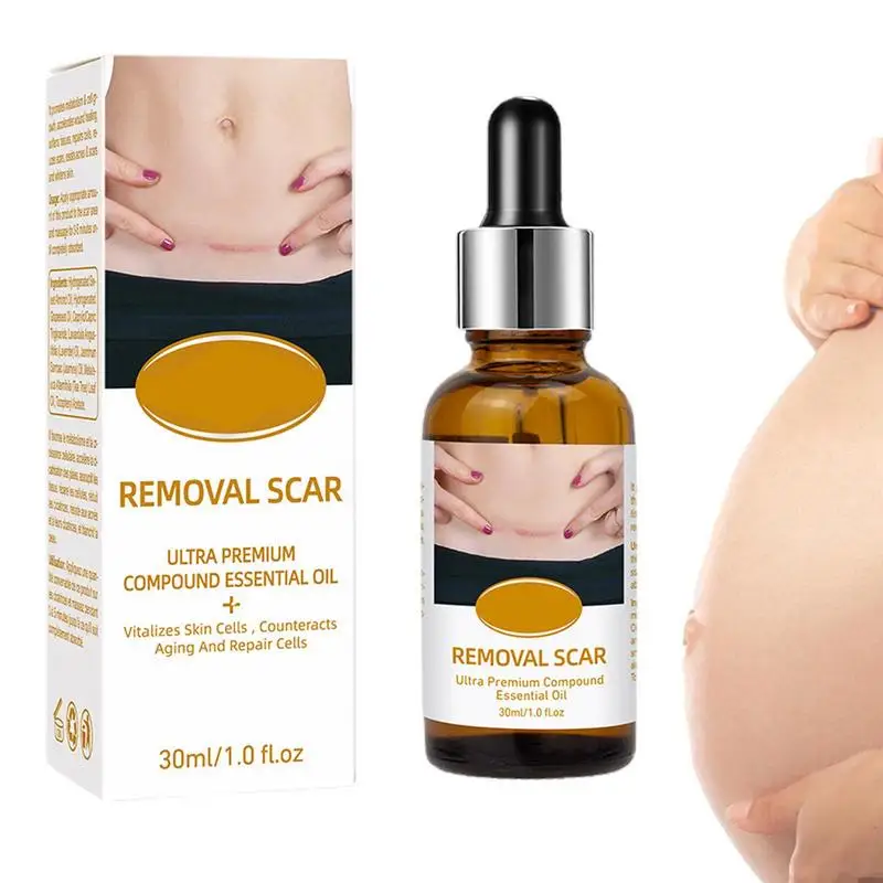 

Scar Removal Oil Skincare Oil For Scars And Stretchmarks Skin Moisturizing Oil Effectively Reduces The Look Of Scars Stretch