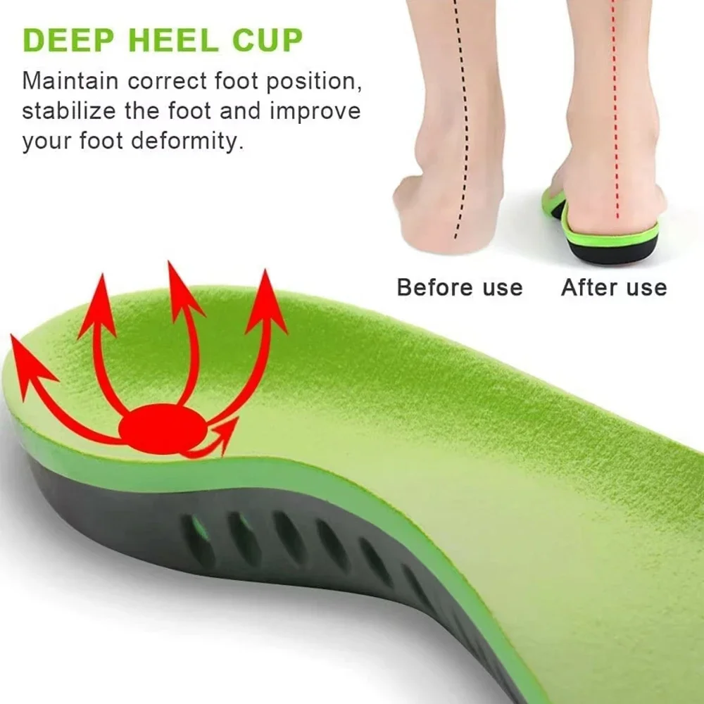 Ортопедические стельки для мужчин и женщин силикагелевые спортивные поддержка