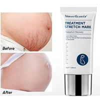 1pcs remove pregnancy scars skin body cream postpartum stretch winkles firming marks body cream repair skin cream anti agin f3g6