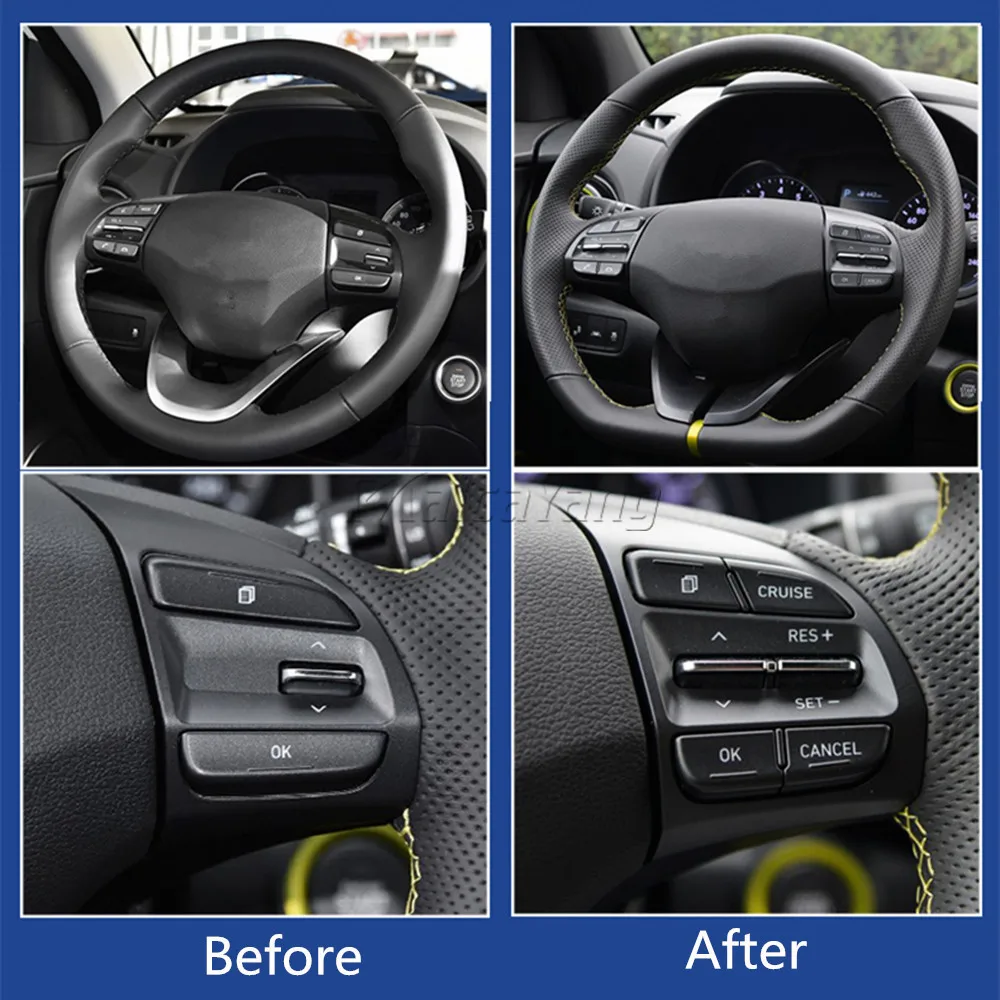 Высококачественный переключатель управления аудио на руль автозапчасти 96720-G2010