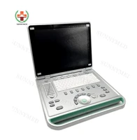 sy a009 pc based laptop ultrasound b scanner with 2 probe connector