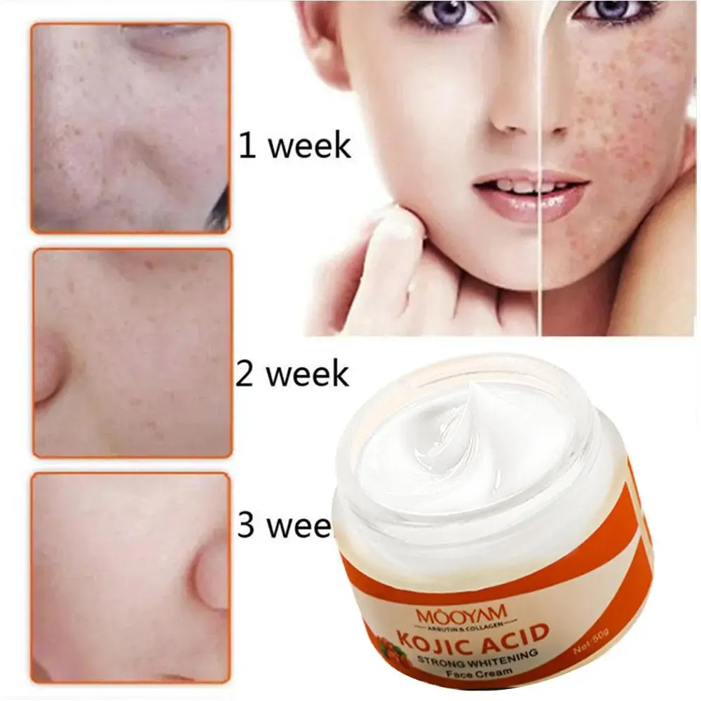 

Kojic Acid Collagen Whitening Cream Face Cream Remove Care Face Cosmetics Spots Firming Skin Moisturizing Care Anti-Aging D J3Y0