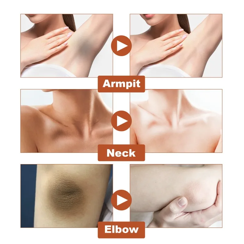 Средство для ухода за кожей Acantho средство против пигментации и темных пятен