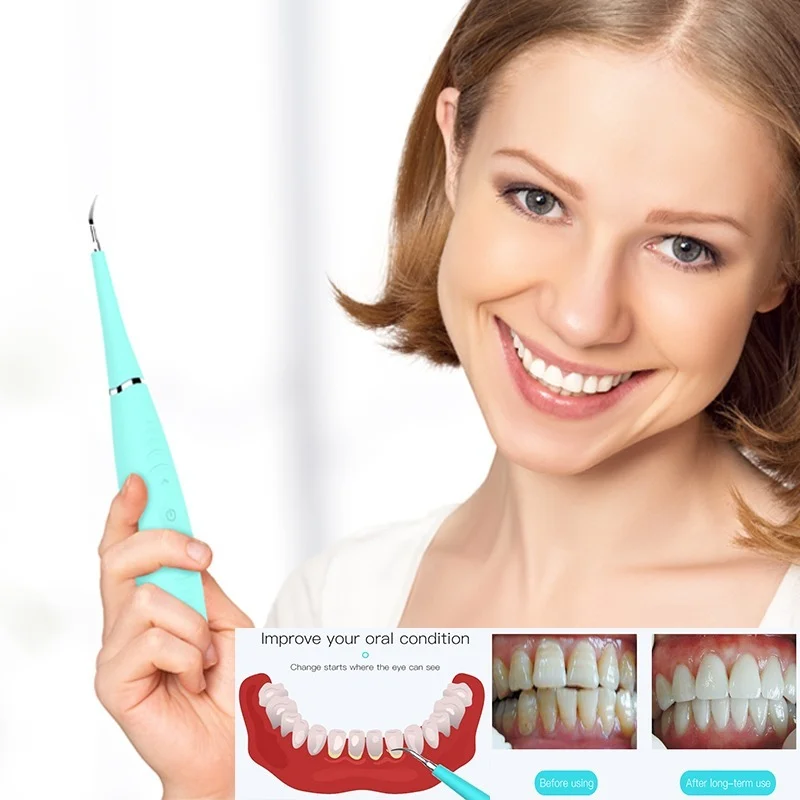 

Portable Electric Sonic Tooth Scaler Tooth Calculus Remover Tooth Stains Tartar Cleaner Tool Whiten Teeth Health Oral Hygiene