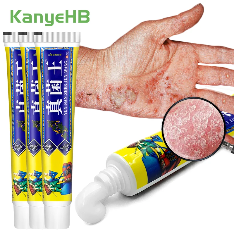 3 шт. лечебная мазь от псориаза и дерматита