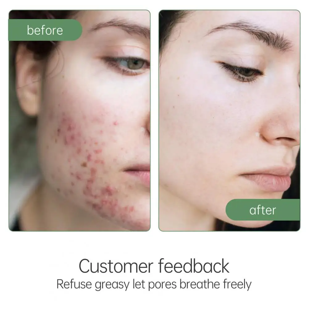 

Oil-control 100ml Fashion Tea Tree Refreshing Facial Cleanser Mild Face Cleanser Gentle for Girl