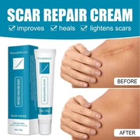 herbal scar removal cream repair gel stretch marks remove acne spots burn surgical treatment face body skin care 20g