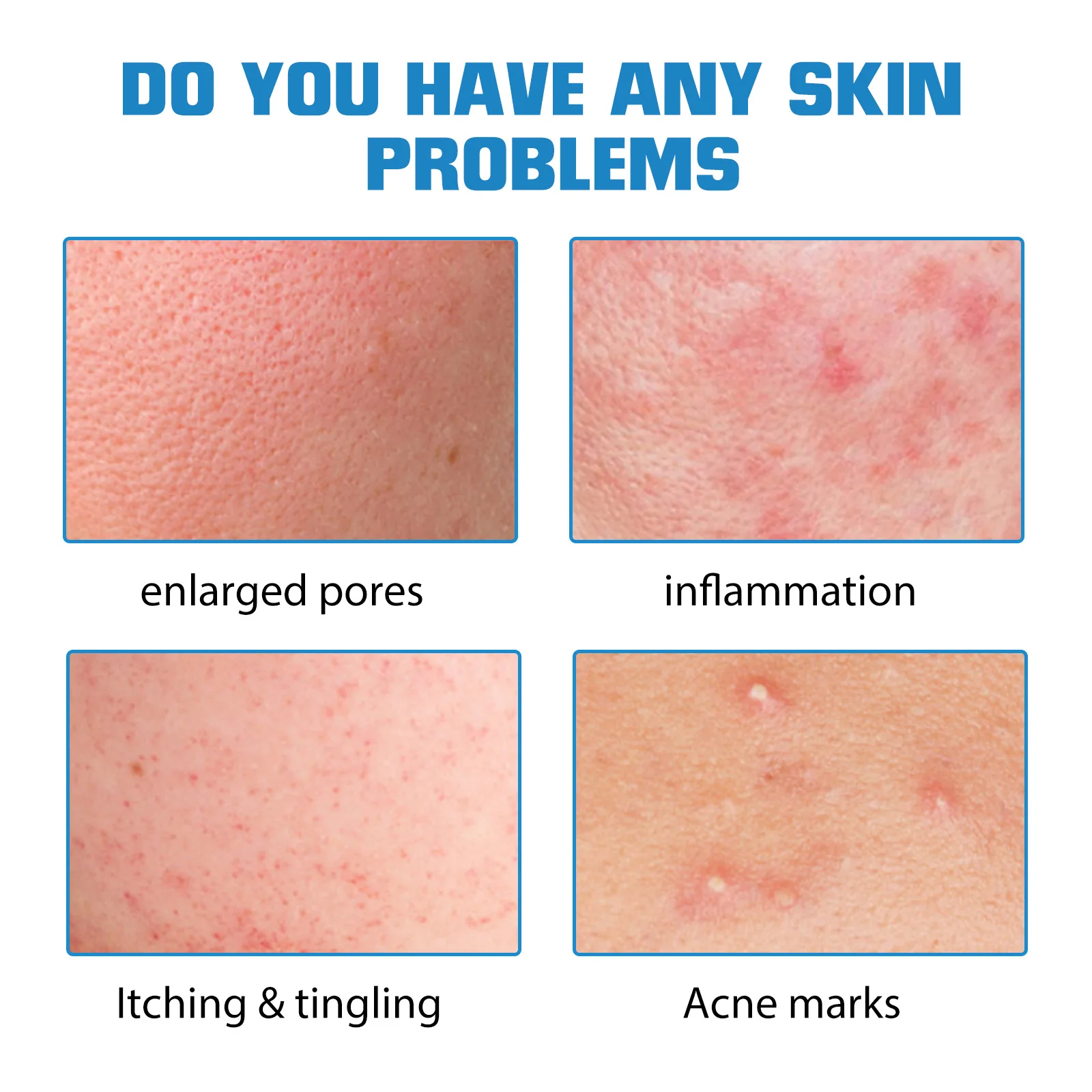 Сыворотка для лица с гиалуроновой кислотой сужающая поры улучшающая обвисшую