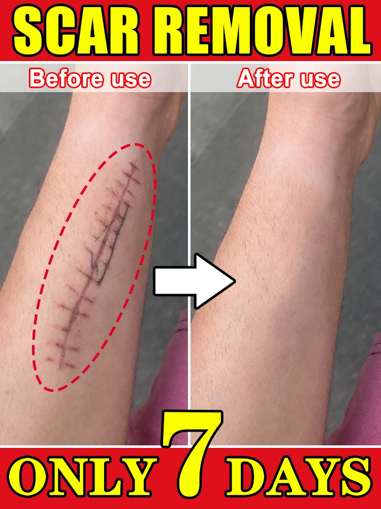 

Формула для здоровья