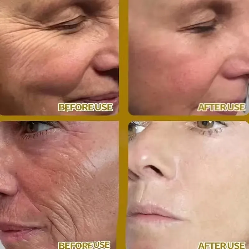 Антивозрастная лифтинг-укрепляющая сыворотка для лица с ретинолом средство