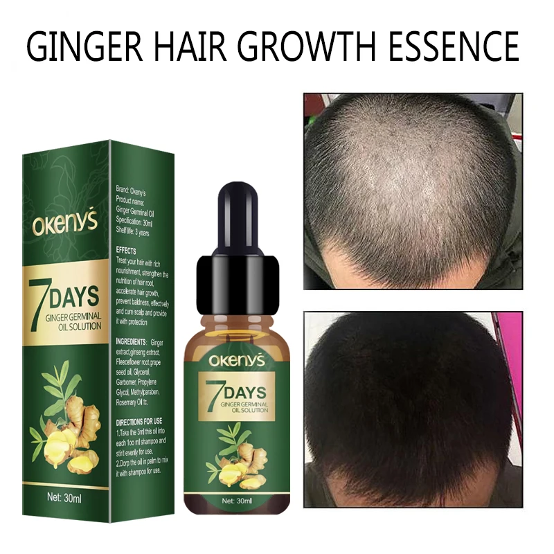 

7 Days Hair Growth Essence Ginger Anti-hair Loss Fast Treatment Scalp Serum Products Prevent Alopecia Damaged Herbal Hair Care