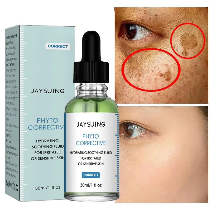 Whitening Serum Fade Dark Spots Freckle Brighten Essence Remove Pigment Melanin Correcting Beauty Face Skin Care Korea Cosmetics