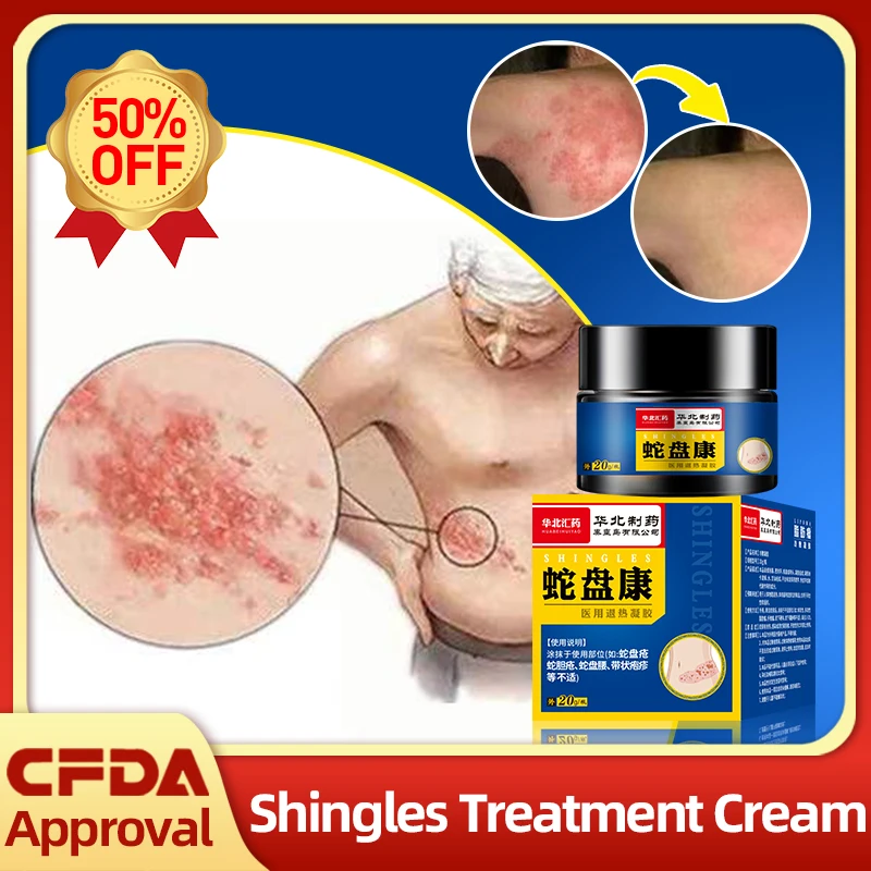 

Shingles Treatment Cream Herpes Simplex Cure Medicine Spray For Snake Disc Sore Anti-Itching Herpes Zoster Ointment 20G/Box