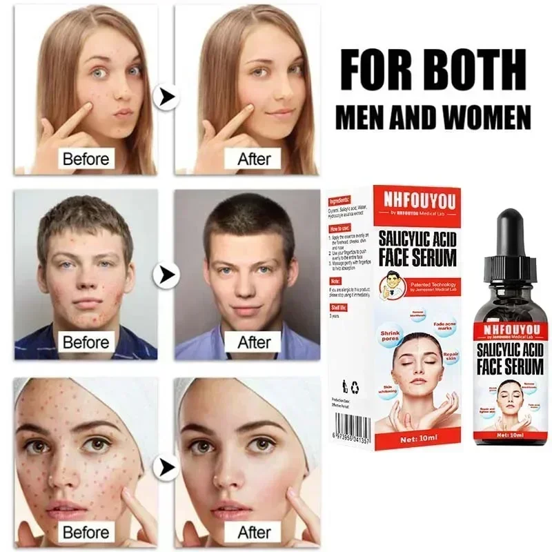 Раствор с салициловой кислотой 10 мл