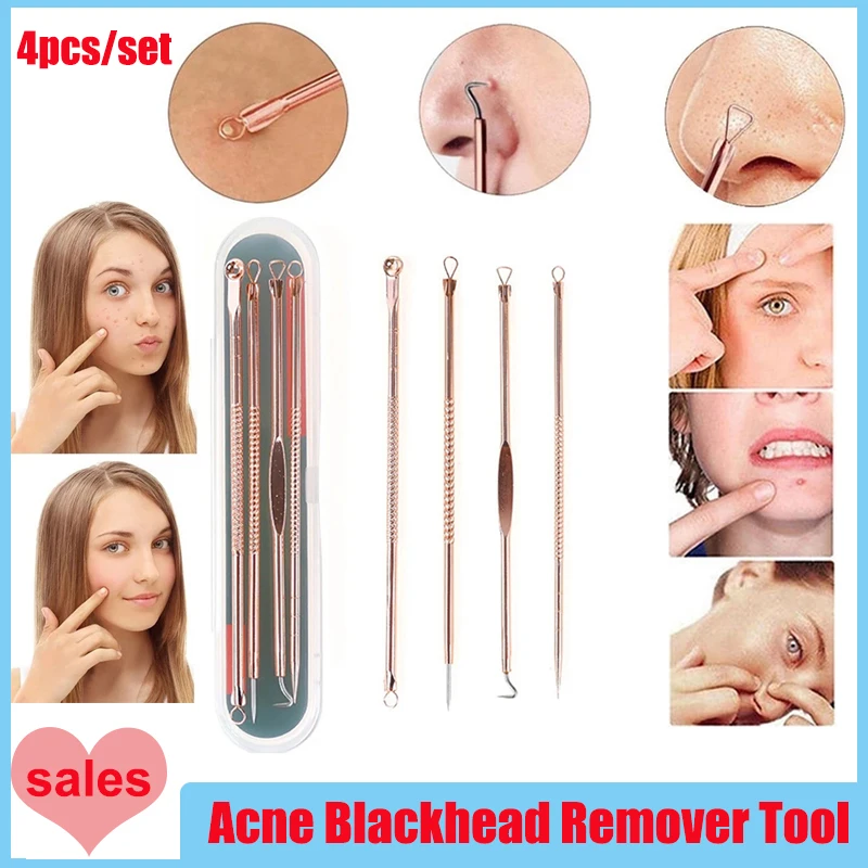 

4PCS Acne Blackhead Comedone Black Spot Pimple Blemish Remover Skin Care Women Beauty Acne Treatment Pore Cleanser Needle Hook