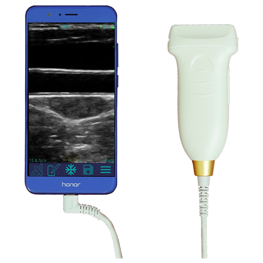 

Amain MagiQ MPUL 10-5E BW Linear Health Care Small-Sized Diagnostics Ultrasound Probe Machine