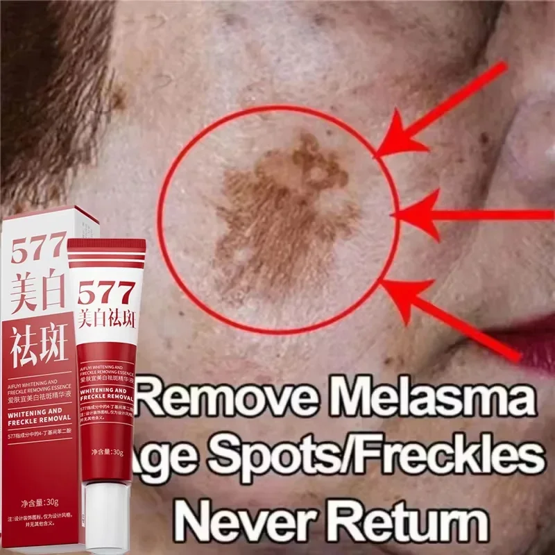 Мощный отбеливающий крем от веснушек удаление мелазмы корректор темных пятен