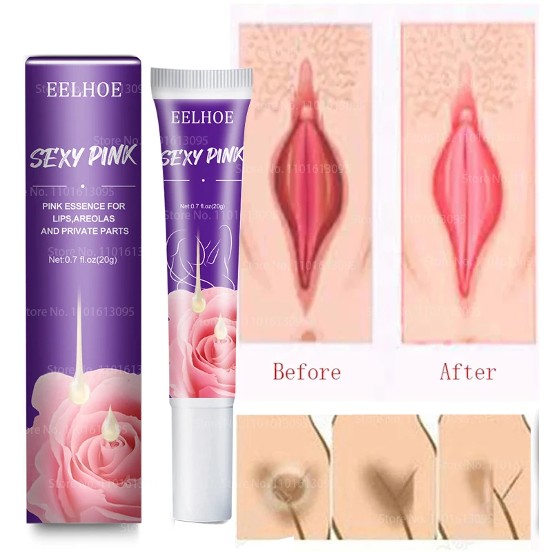 

Private Parts Pink Essence Whitening Fades Pigmentation Relieve Rough Skin Dull Nourish Repair Brighten Sexy Charming Body