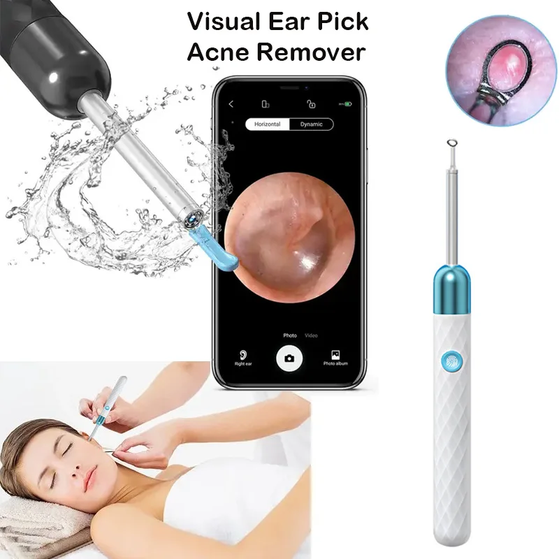 

Suear X3 5MP HD Endoscope 6 Axis Gyroscope Silicone Ear Tip Cover Smart Video Otoscope Prices