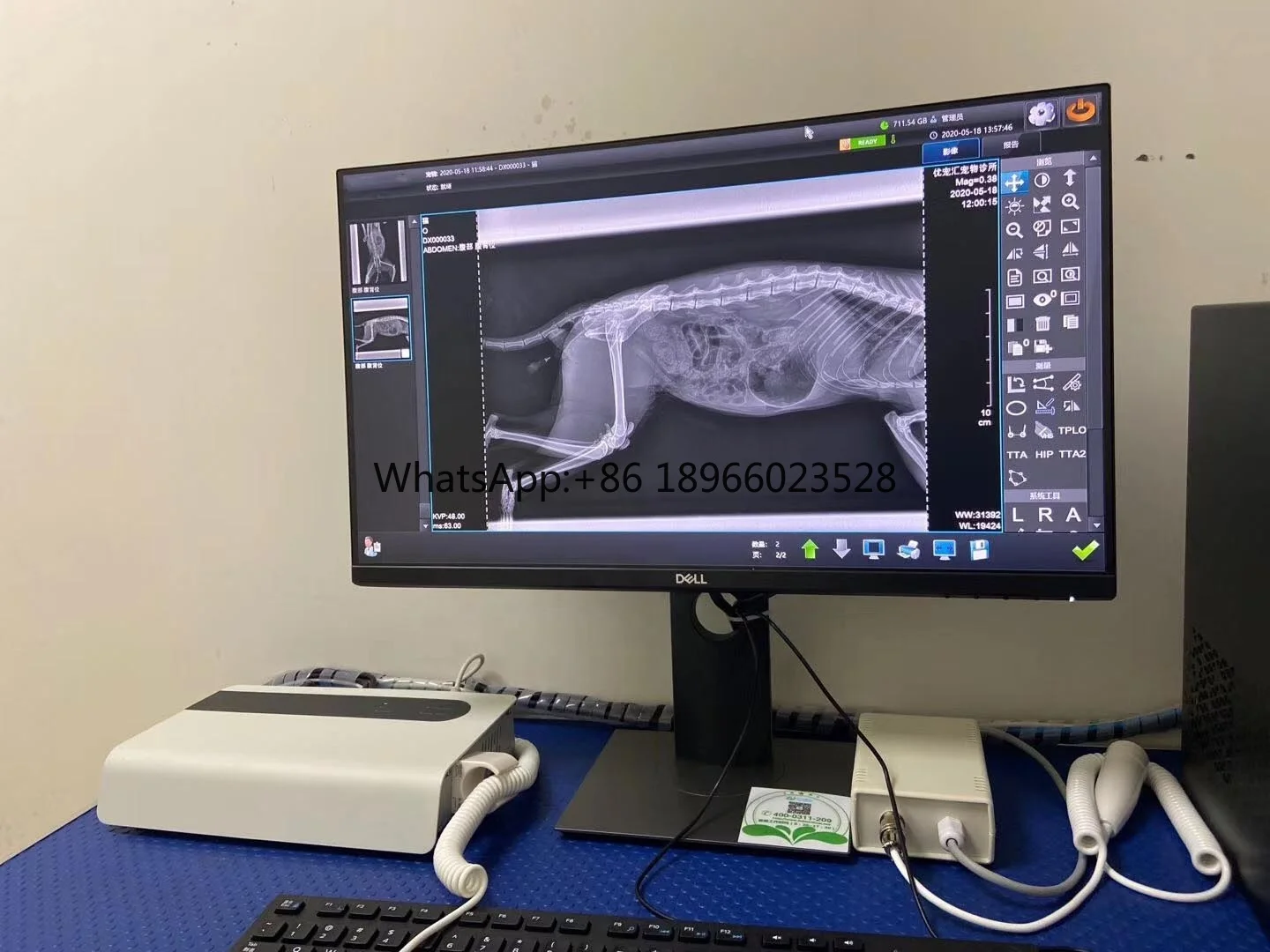 Высококачественный цифровой радиографический плоский панельный детектор Iray Mars