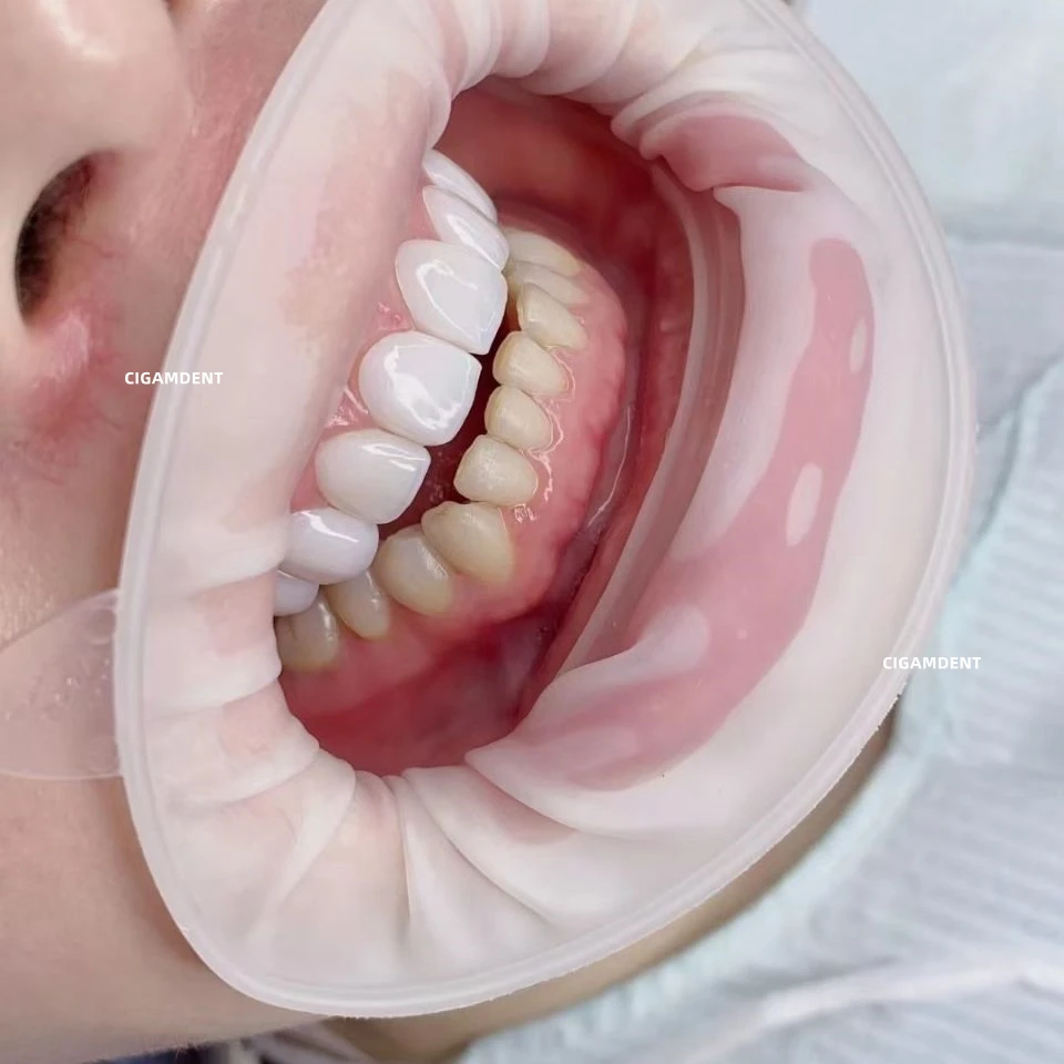 Стоматологическая стерильная резиновая плотина 10 шт